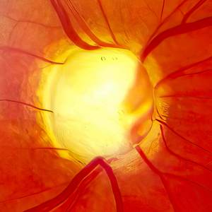 Eye Cells May Have Been Rejuvenated for the First Time in People